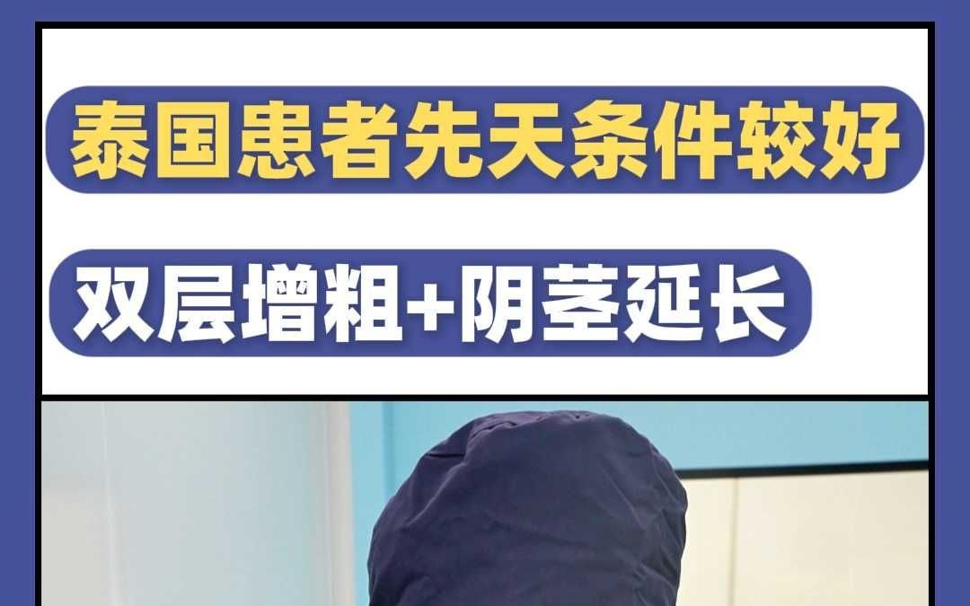 泰国患者 先天条件比较好三片46补片 双层增粗+阴茎延长