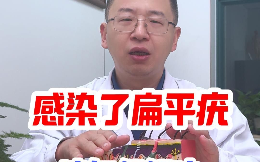 感染了扁平疣该如何解决
