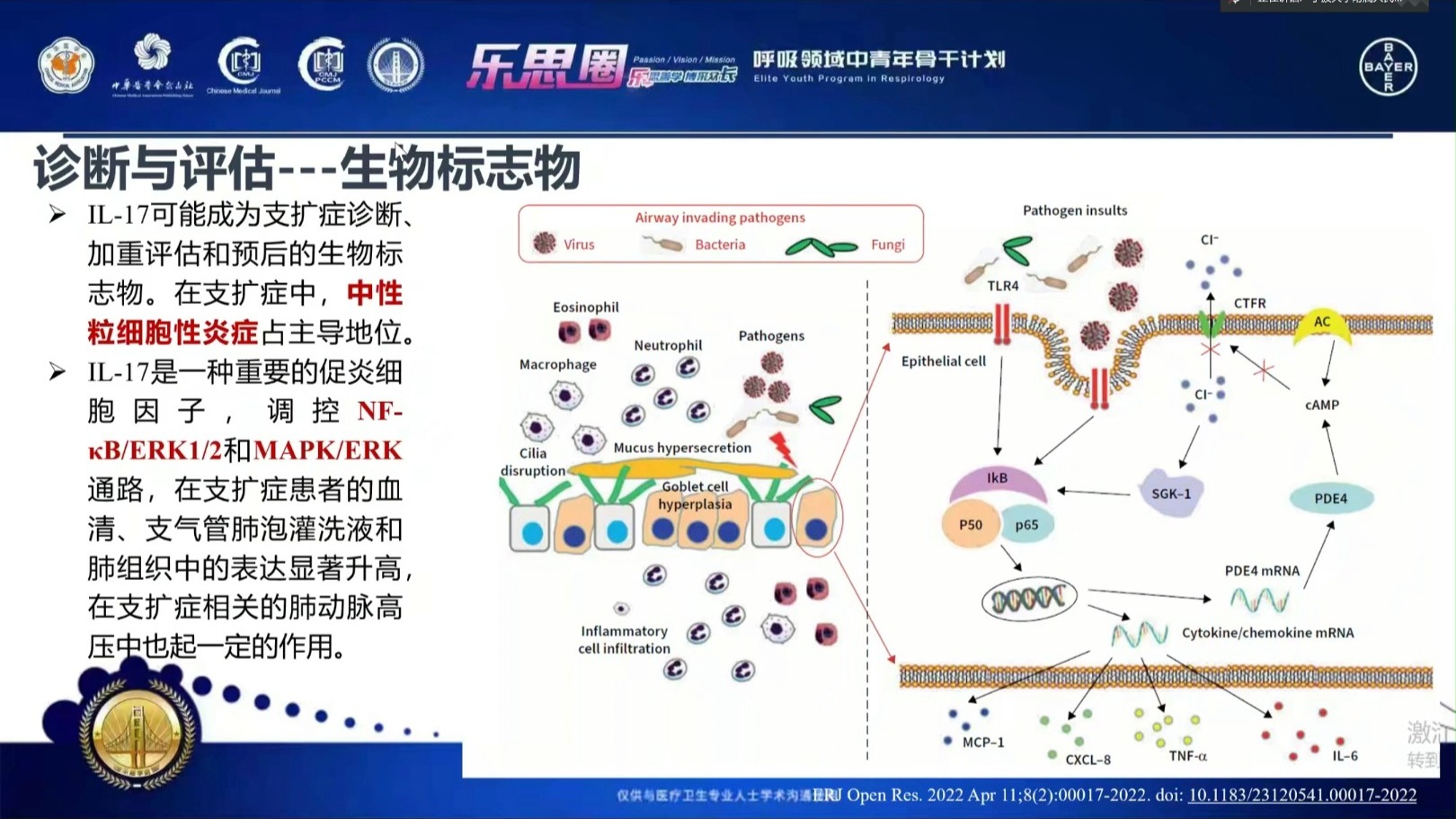 成人支气管扩张（症）的诊治及研究进展 徐涛