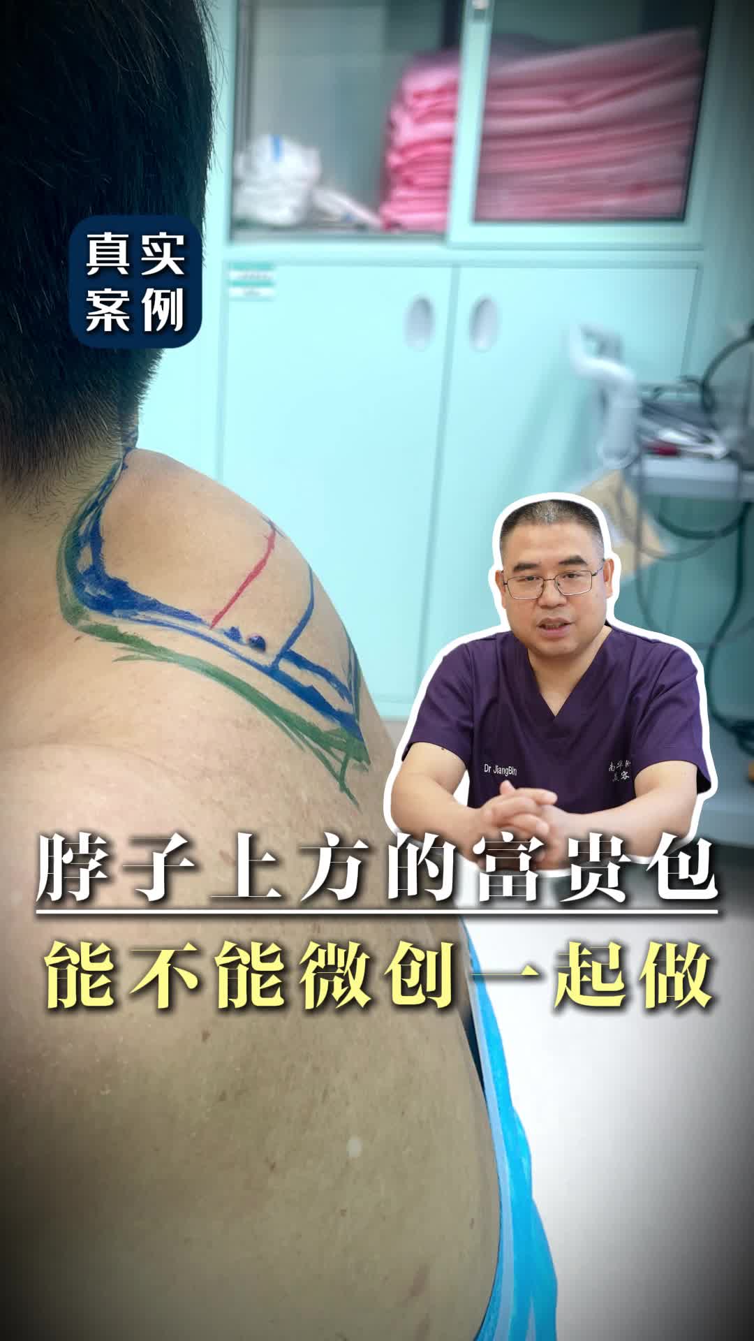 脖子上也鼓了个包，能和富贵包一起手术吗？