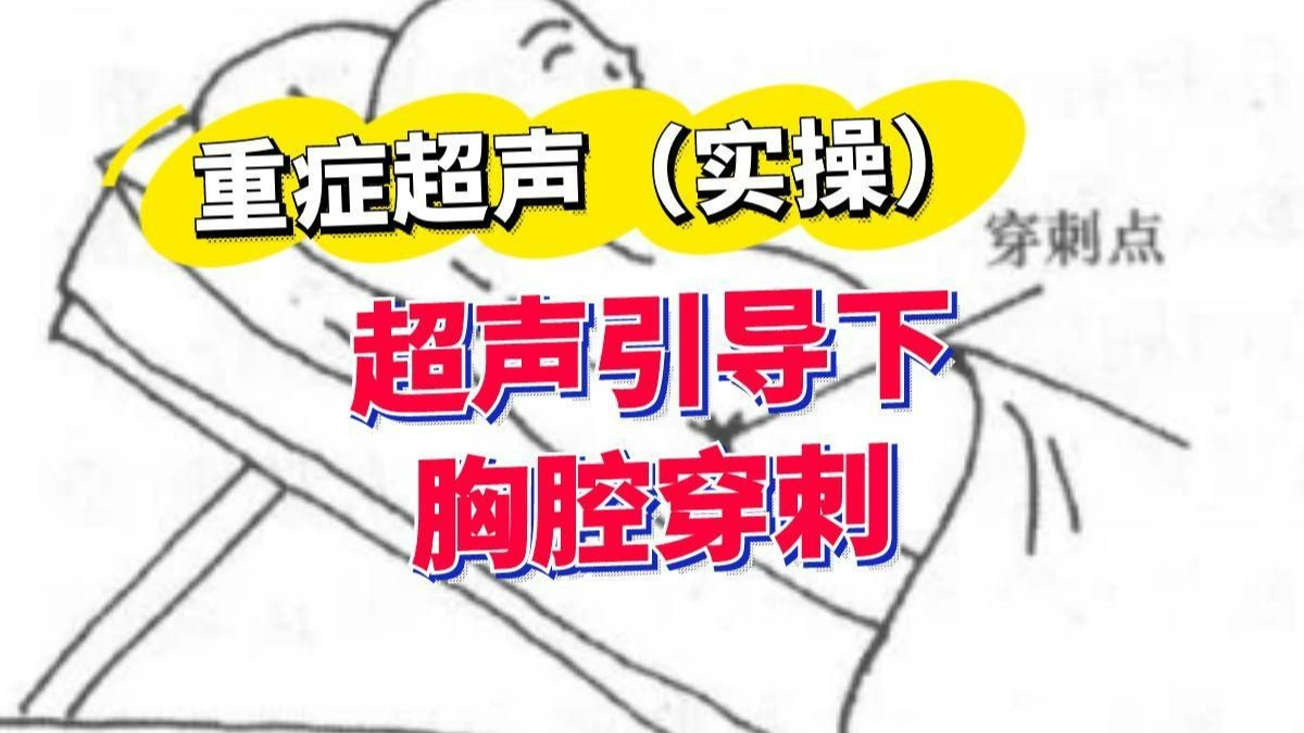 重症超声-肺部超声-胸腔穿刺胸腔积液