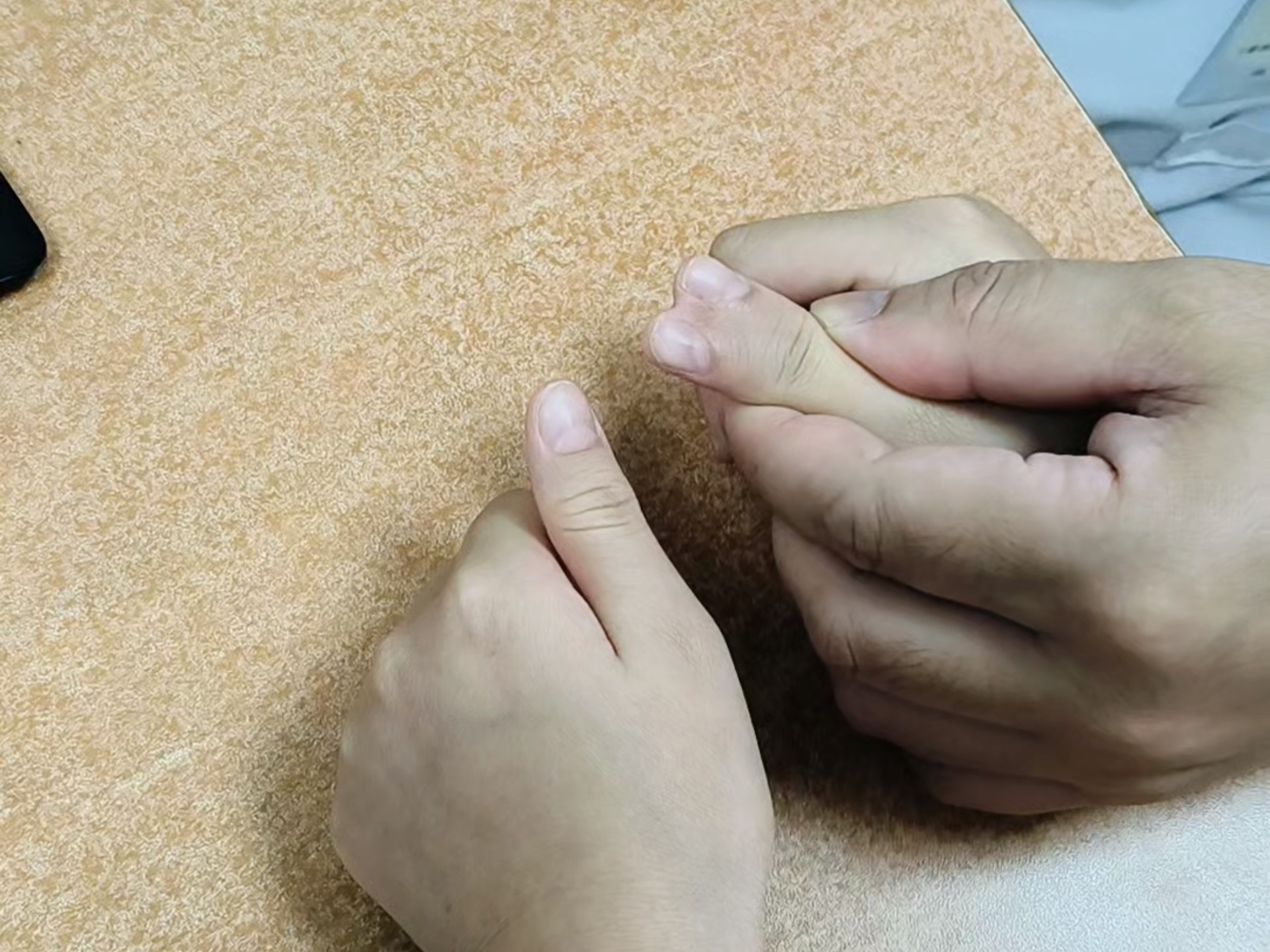 多指畸形多指的小朋友长大后会有心里阴影吗？