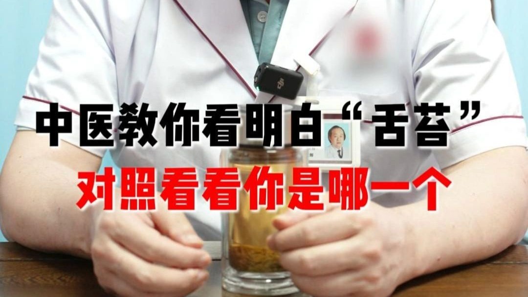 中医教你看明白舌苔，对号入座你是哪一个！