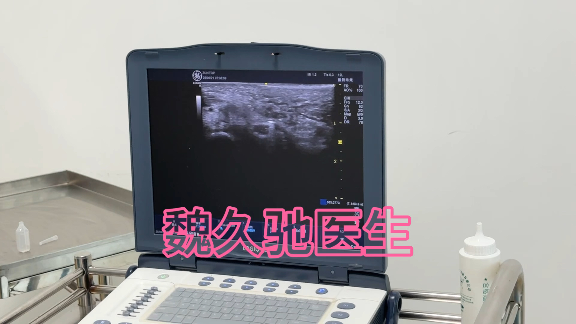 腕管综合征微创技术