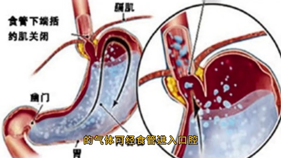 反复口臭去医院挂什么科好？口博仕医学研究院治口臭给力