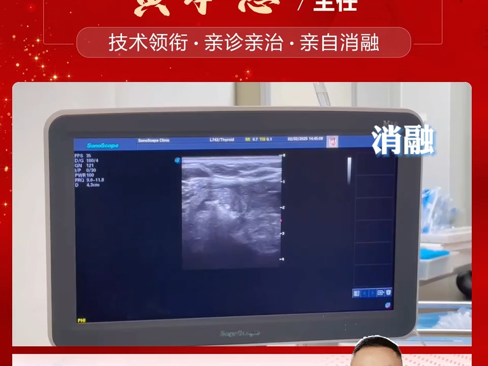 南京治疗甲状腺哪家好-南京长江医院：3.5公分结节+多个2公分以