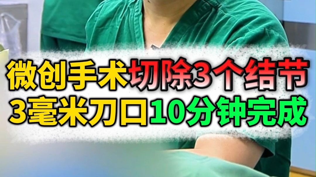 微创手术切除3个结节，3毫米刀口10分钟完成