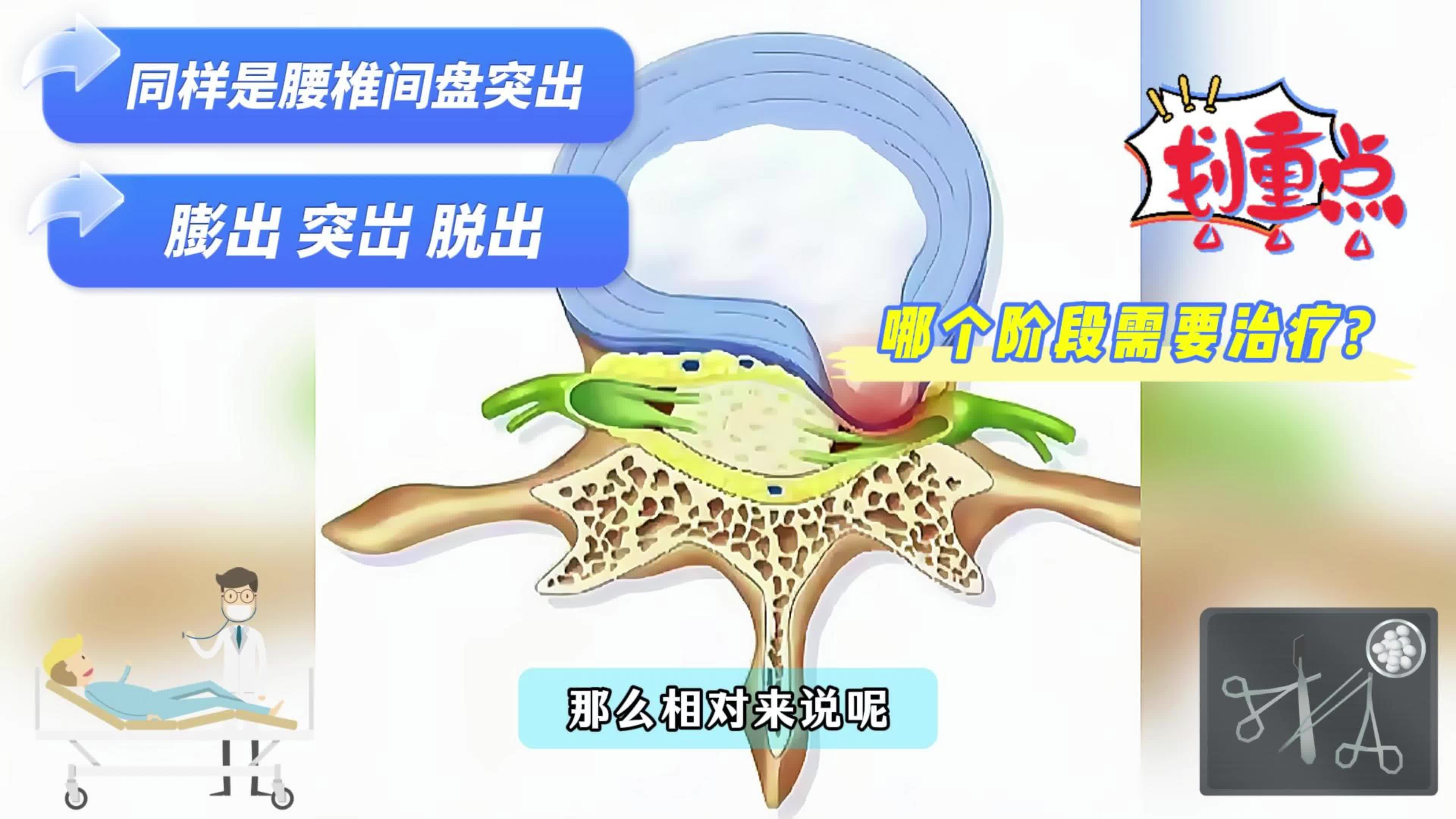 同样是腰椎间盘突出  哪个阶段需要治疗！！