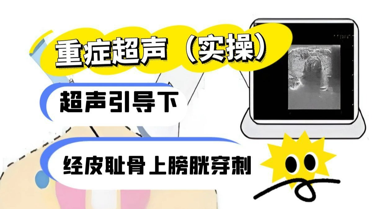 重症超声-超声引导下经皮耻骨上膀胱穿刺