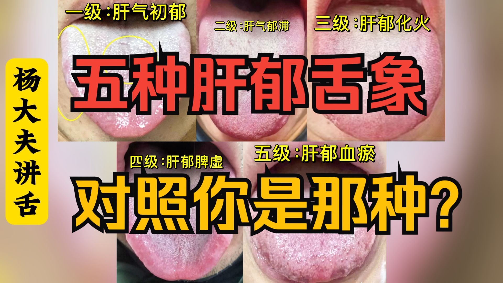 肝郁的5个等级，1个视频告诉你，看看你是哪一种？