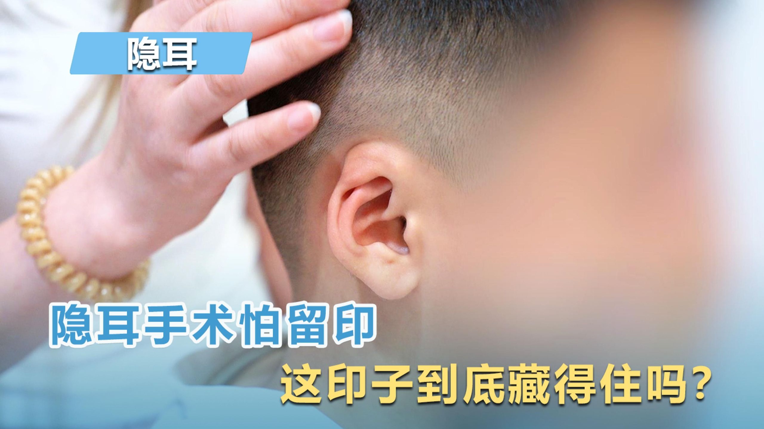 隐耳手术怕留印，这印子到底藏得住吗？