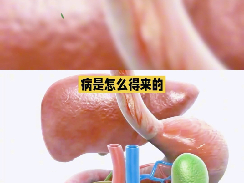 健康科普