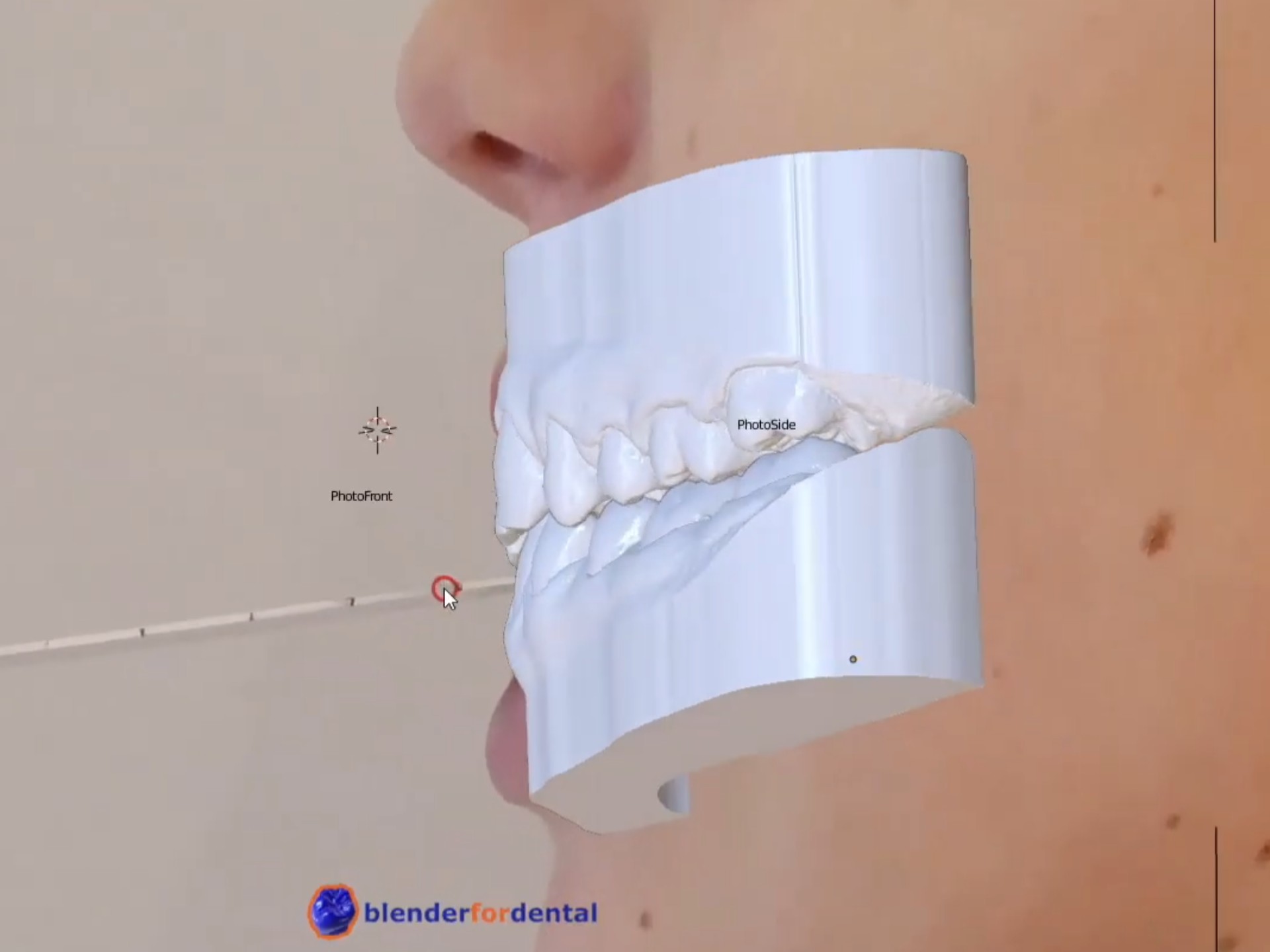 Blender for dental 【B4D】在牙科设计软件中的应用，不仅仅是