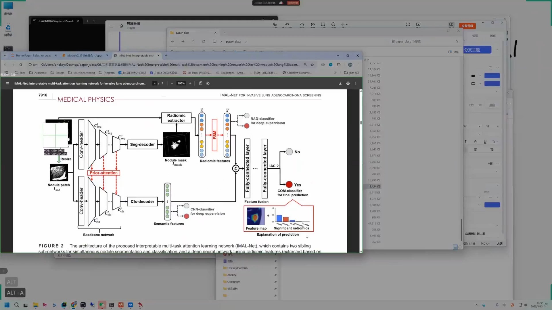 DME患者个性化治疗反应的深度学习评估
