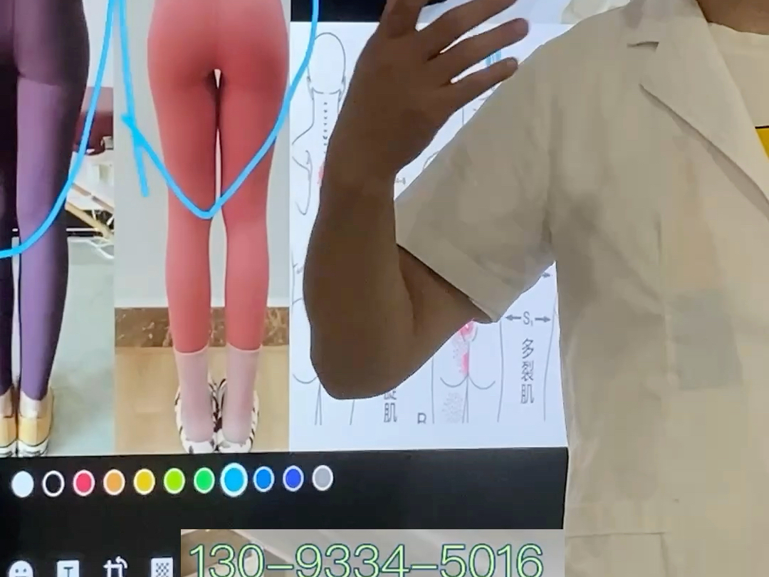 淇县腰间盘突出保守治疗有哪些方法？哪里治疗最好？