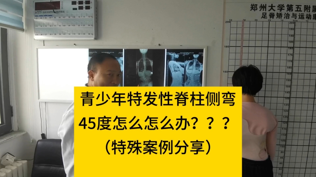 45度脊柱侧弯怎么办？