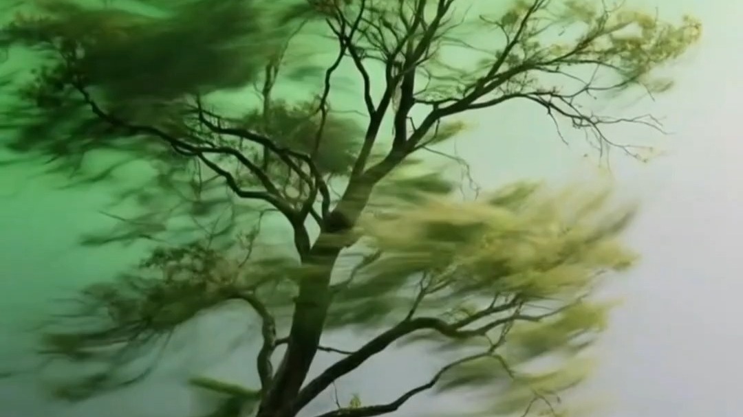 小脑萎缩多系统萎缩