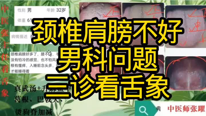 颈椎肩膀不好 男科问题 三诊看舌象