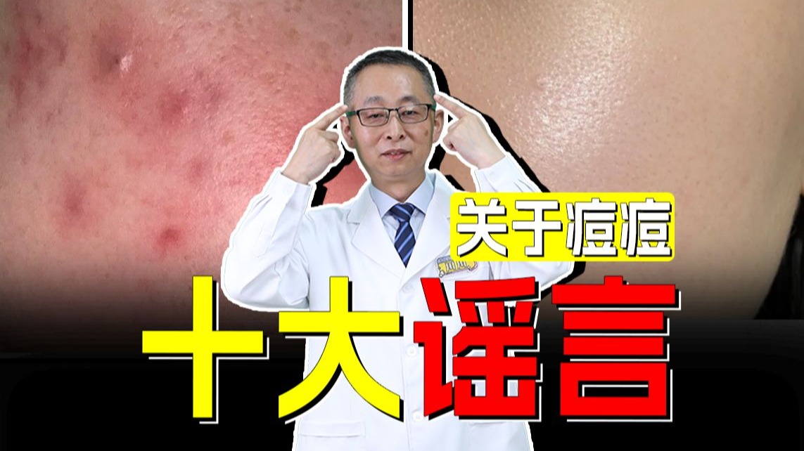 【皮肤科教授】信了这些，痘痘越治越多
