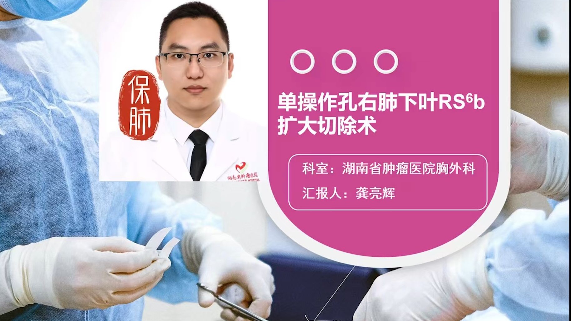 单操作孔右肺下叶RS6b扩大切除术-含手术思路、操作解析、总