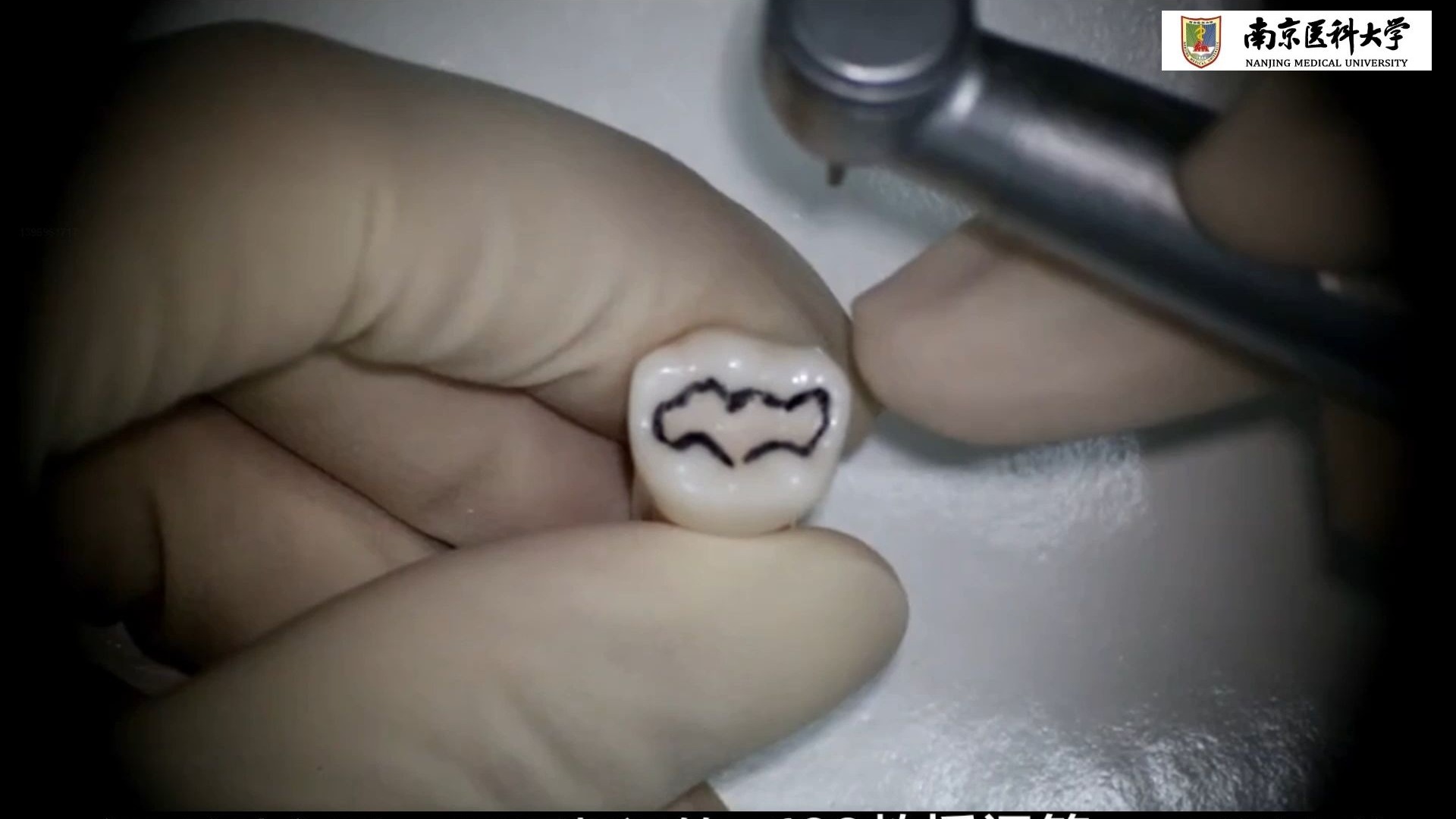 Ⅰ类洞仿真牙预备