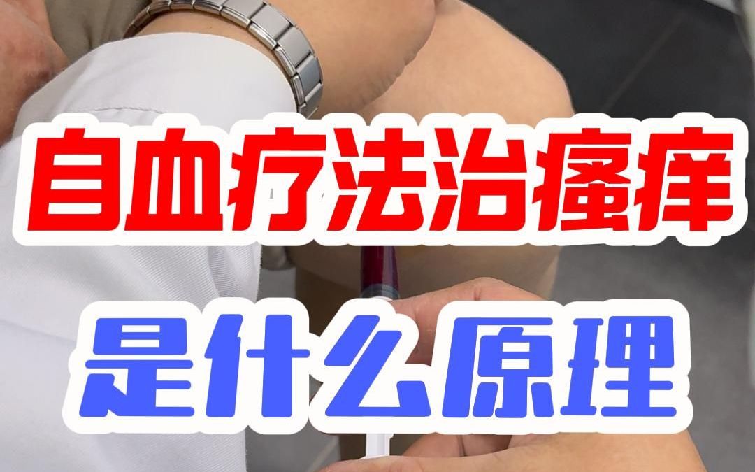 自血疗法治瘙痒是什么原理