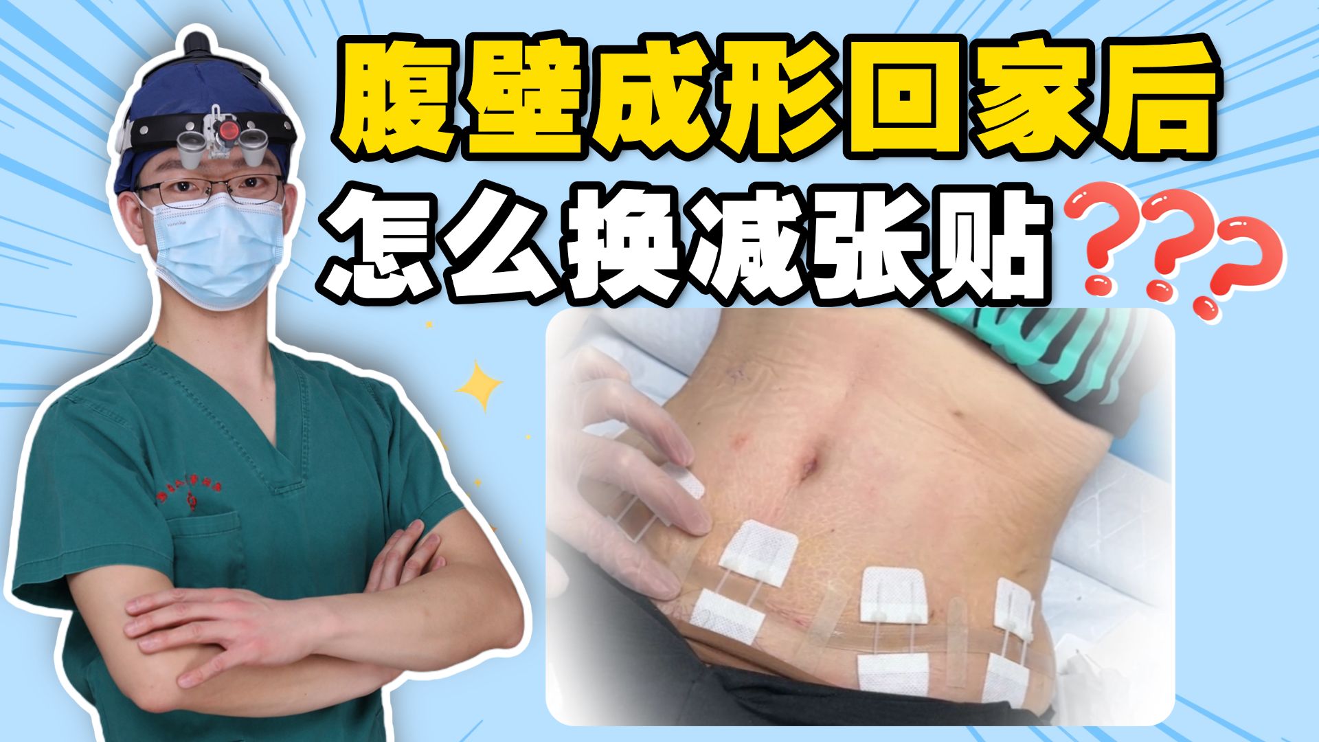 一个视频讲清楚！腹壁术后回家怎么换减张贴