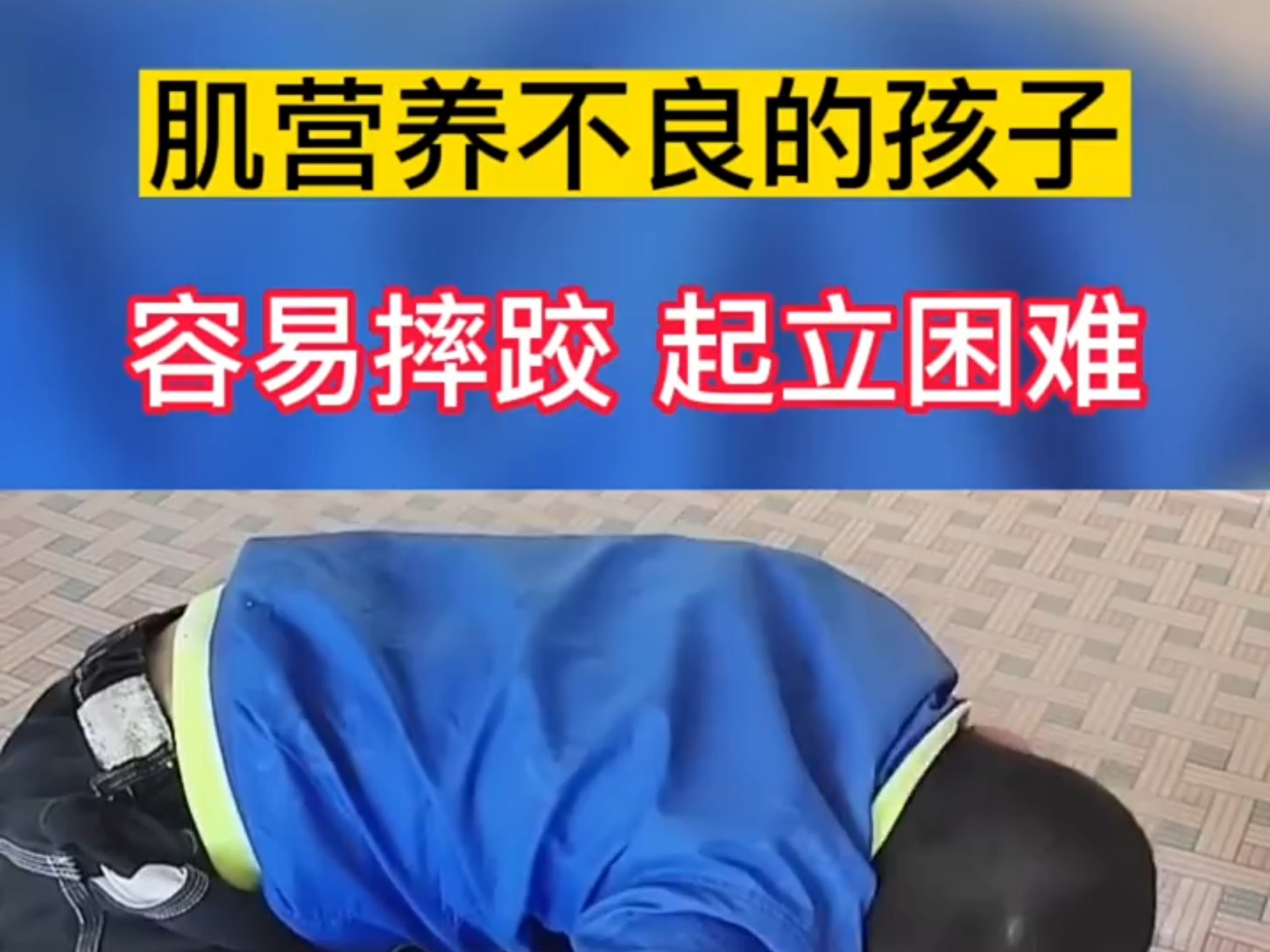 杜氏肌营养不良 杜氏肌营养不良