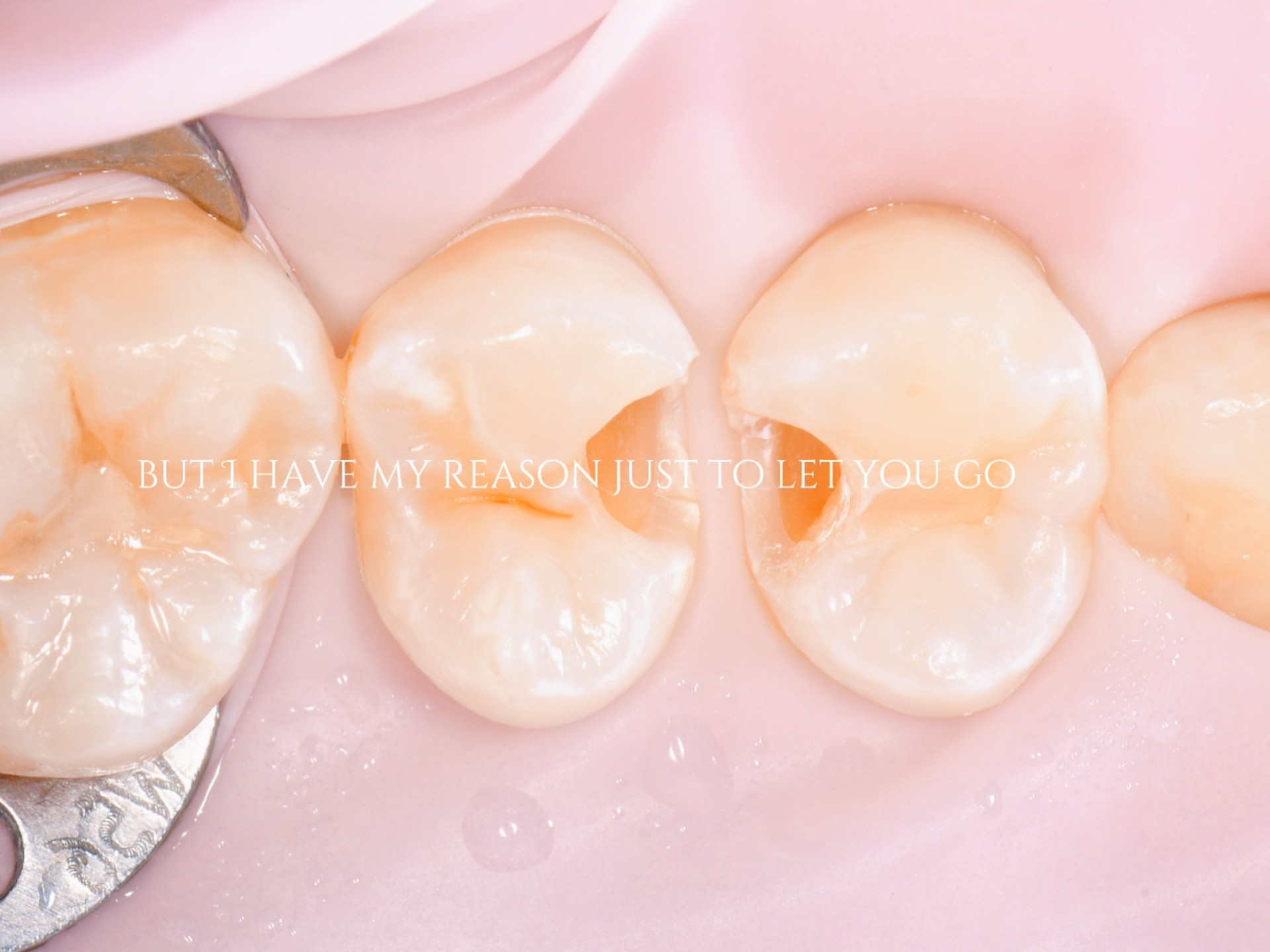 口腔医生养成计划 今天补个牙