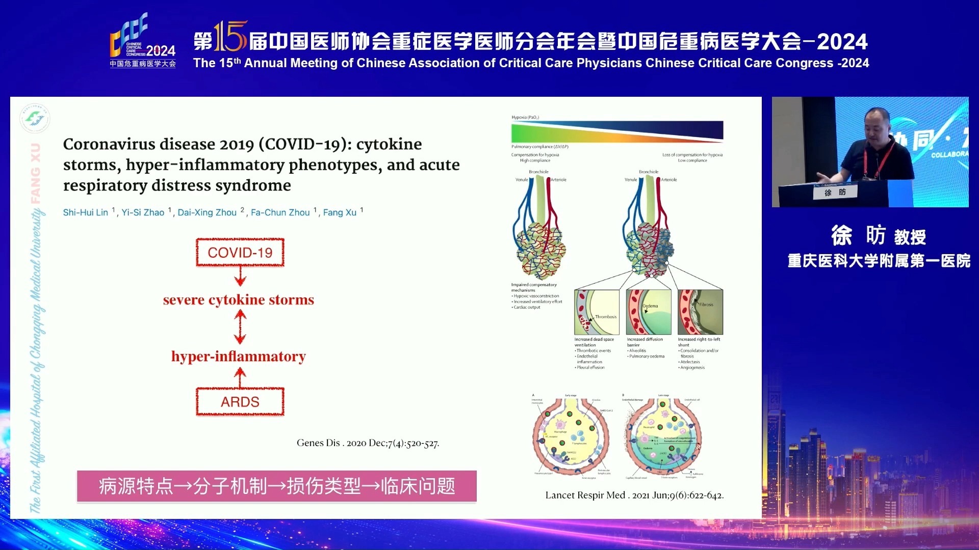 我们真的需要ARDS吗？  徐昉