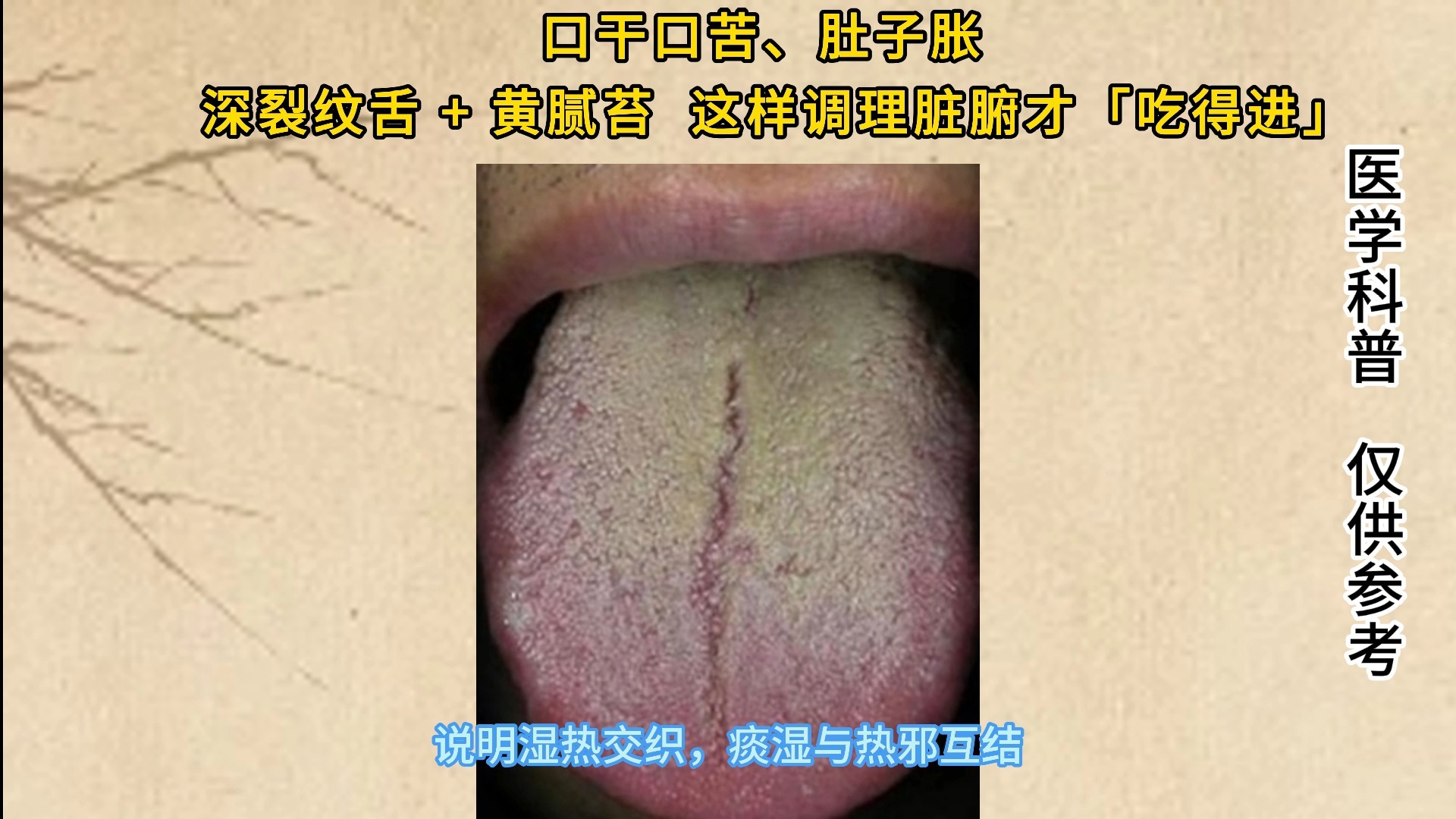 口干口苦、肚子胀？深裂纹舌 + 黄腻苔，这样调理脏腑才「吃得进