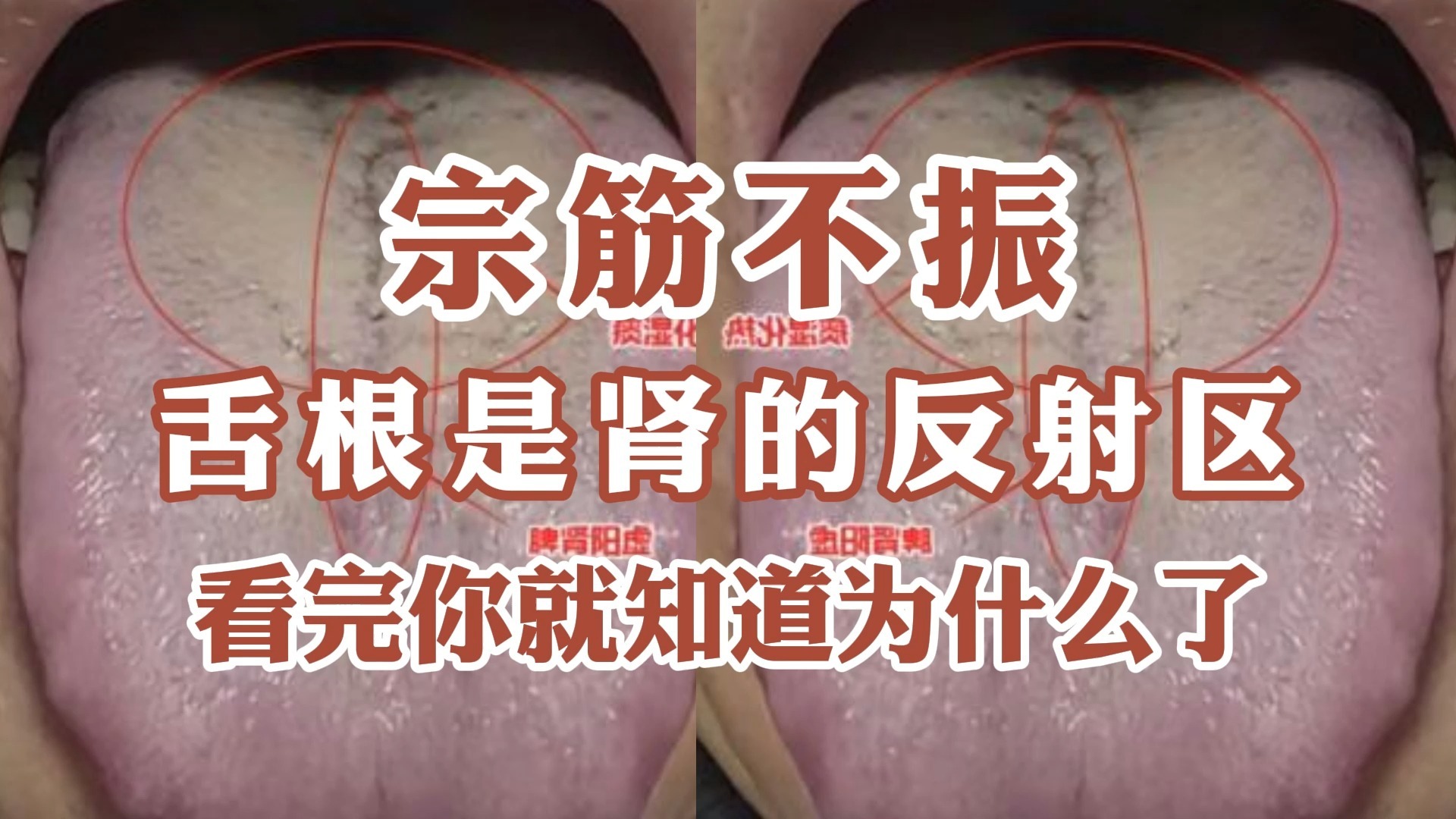 宗筋不振舌根是肾的反射区，看完你就知道为什么了