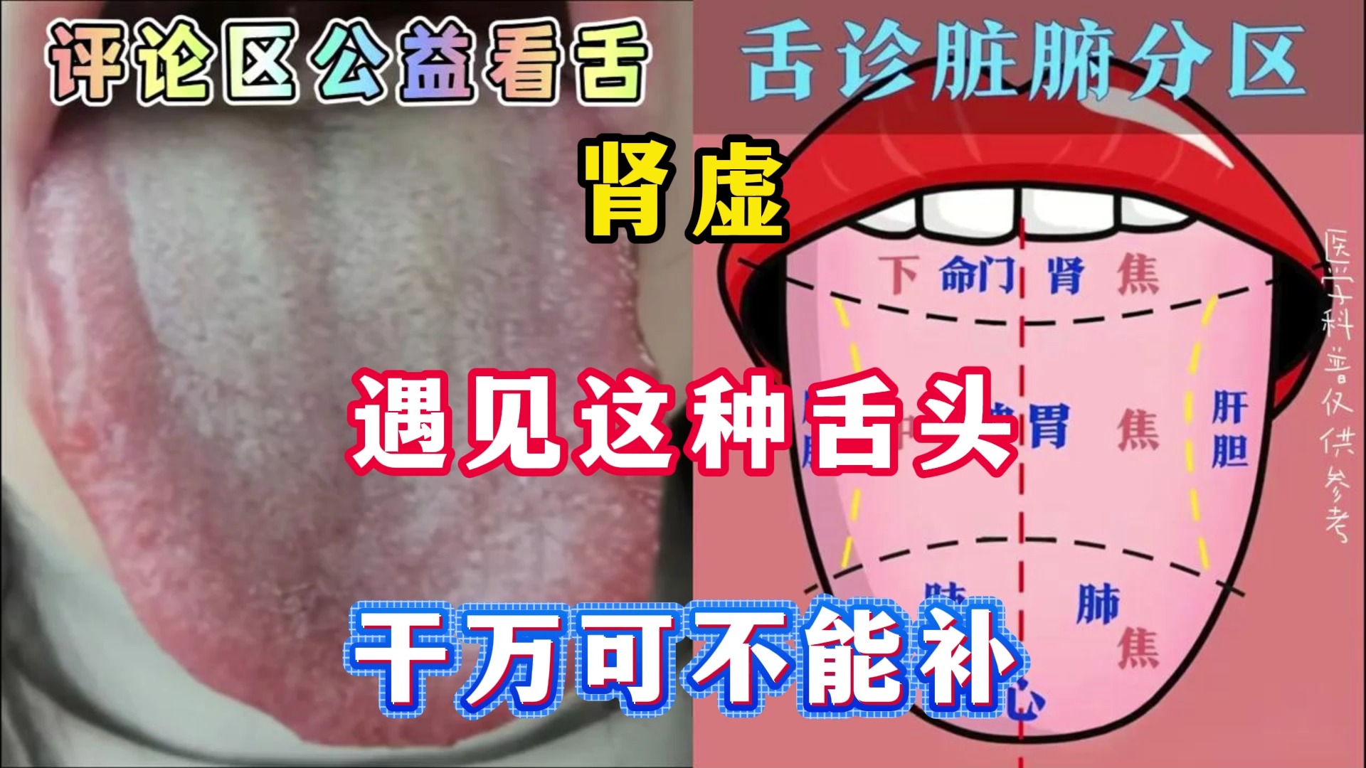 肾虚遇见这种舌头，干万可不能补