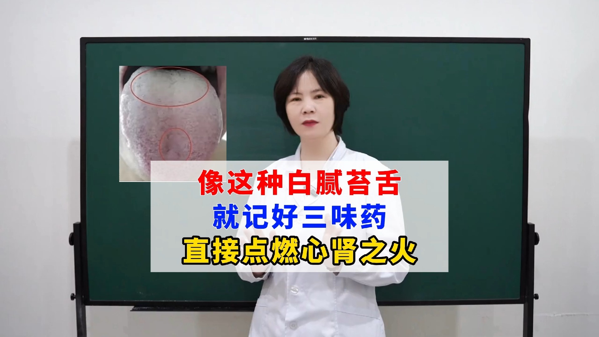 像这种白腻苔舌，就记好三味药，直接点燃心肾之火，阳气取之不尽