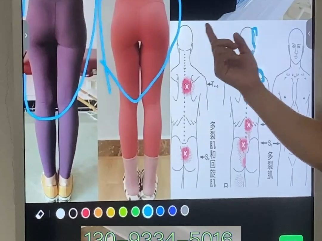 鹤山区腰间盘突出保守治疗有哪些方法？哪里治疗最好？