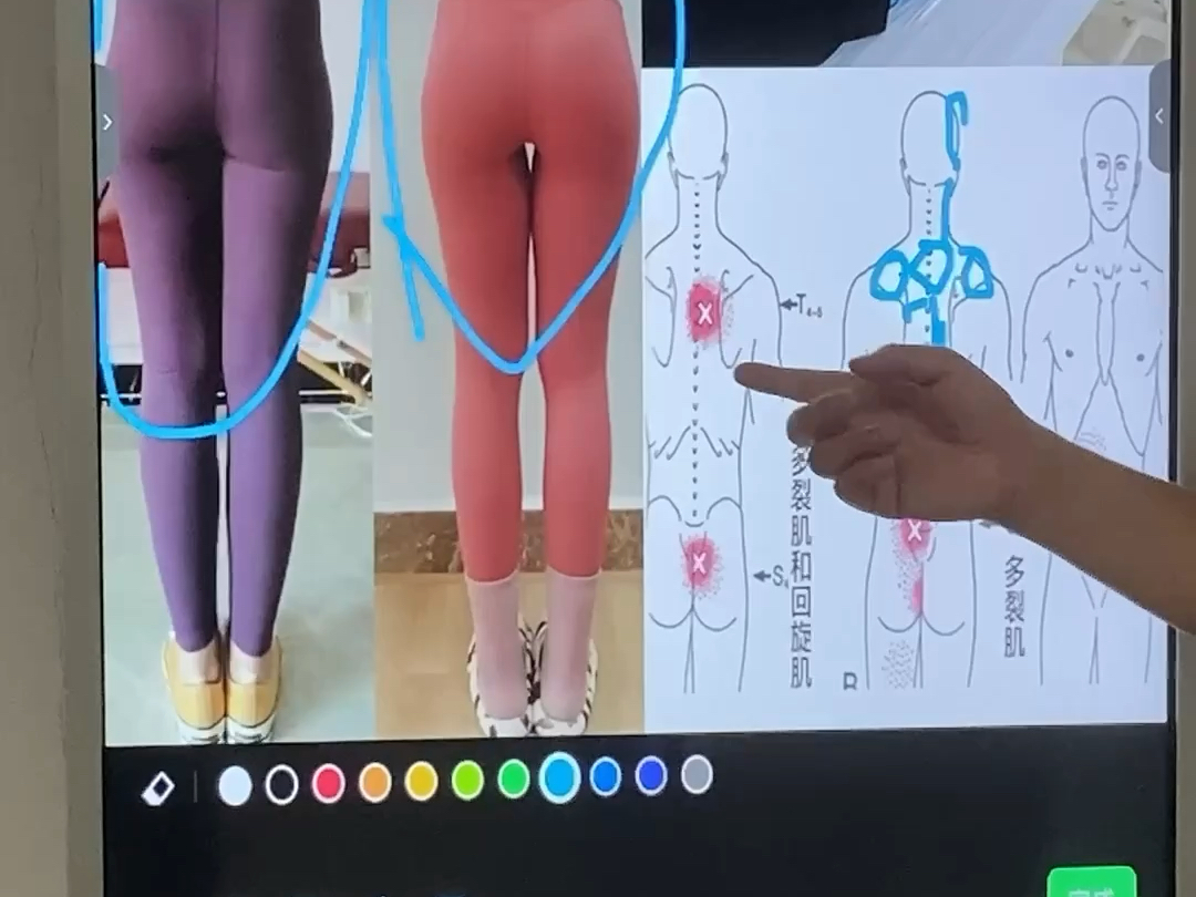 济宁市谁看腰疼腿疼腰突最好最有名气？