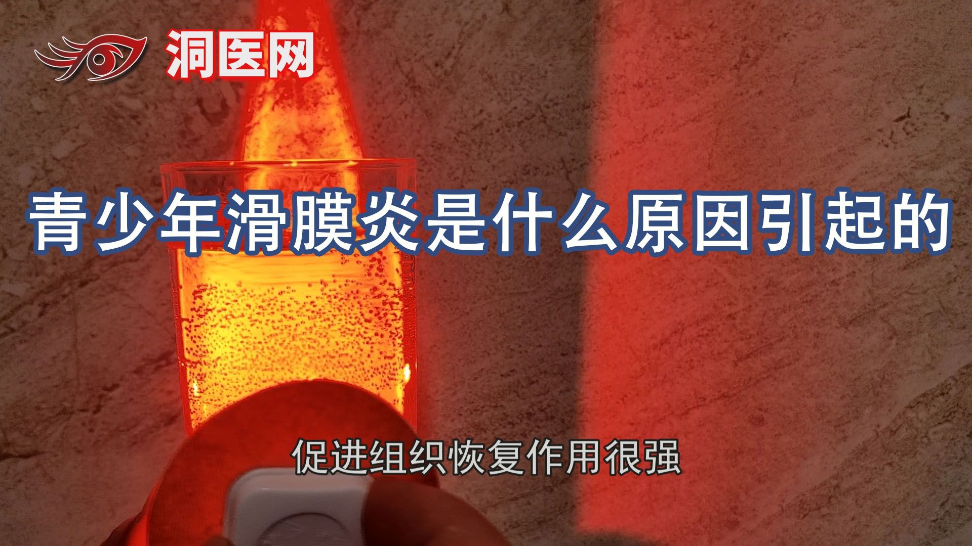 青少年滑膜炎是什么原因引起的