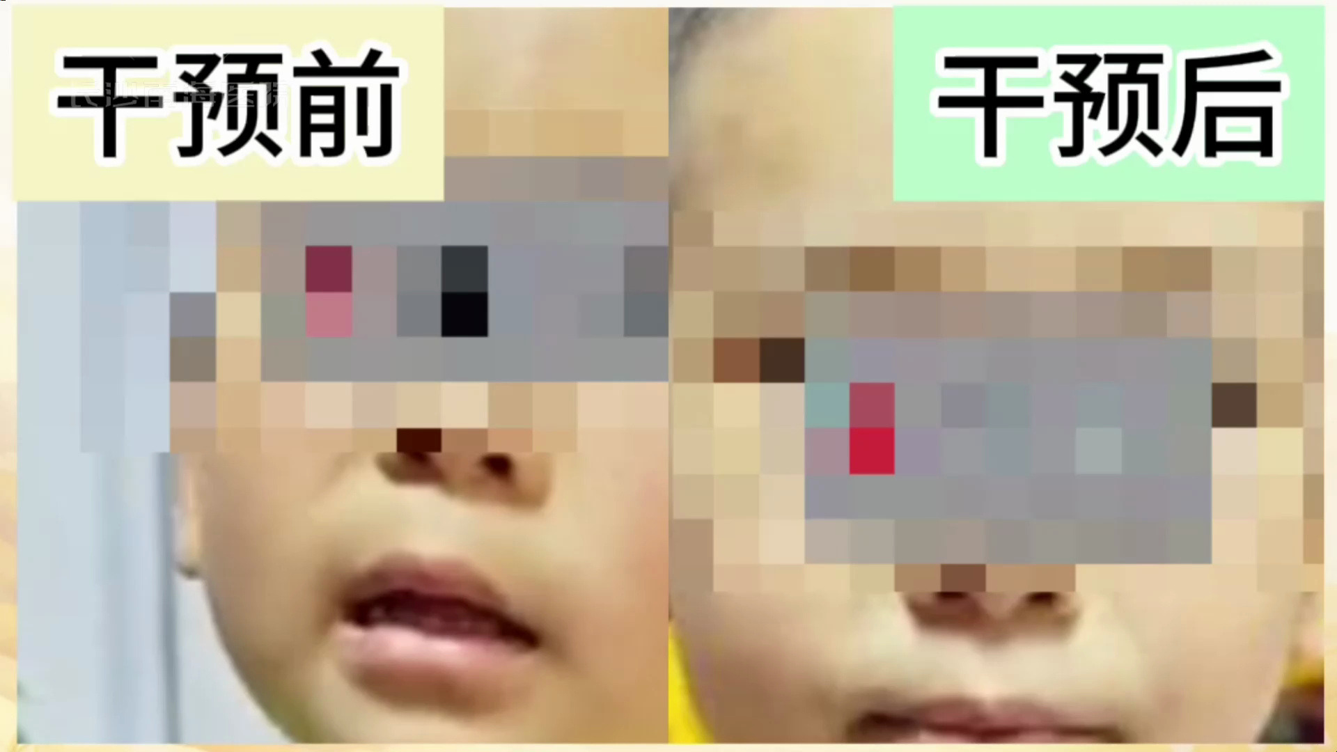 长沙南海对口齿不清的干预怎么样