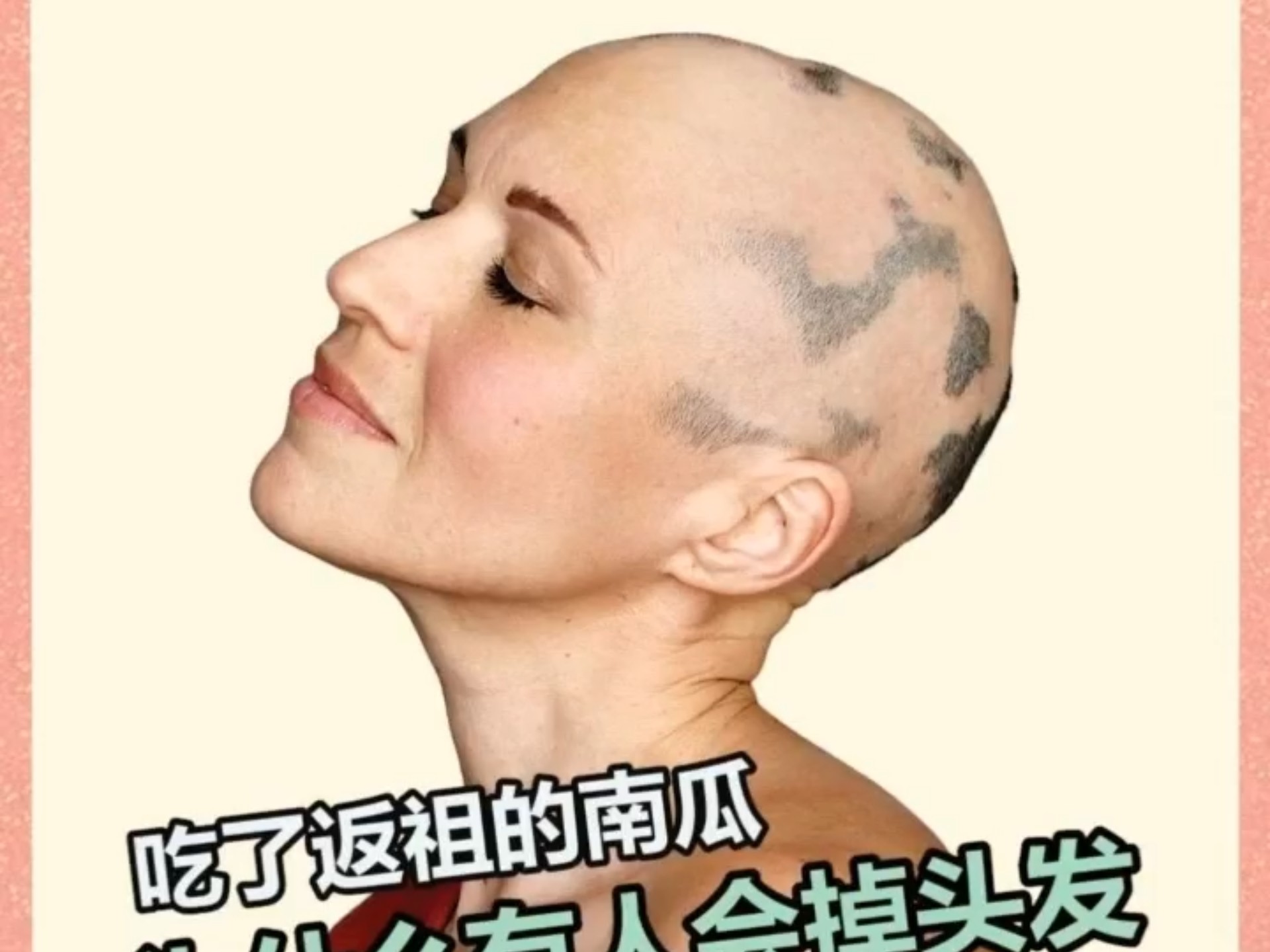 吃错南瓜掉头发