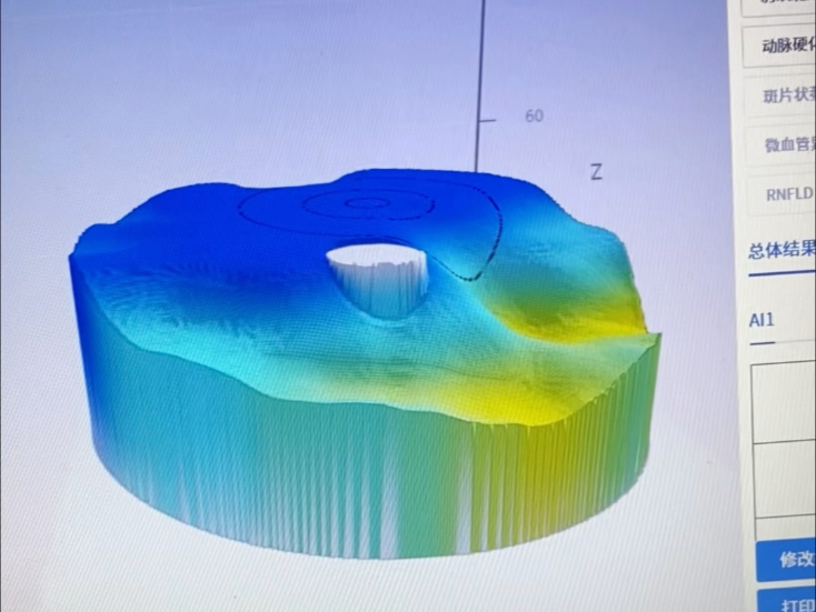 激活凋亡视细胞给大脑输送完整信息