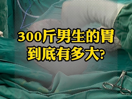 300斤男生的胃有多大？