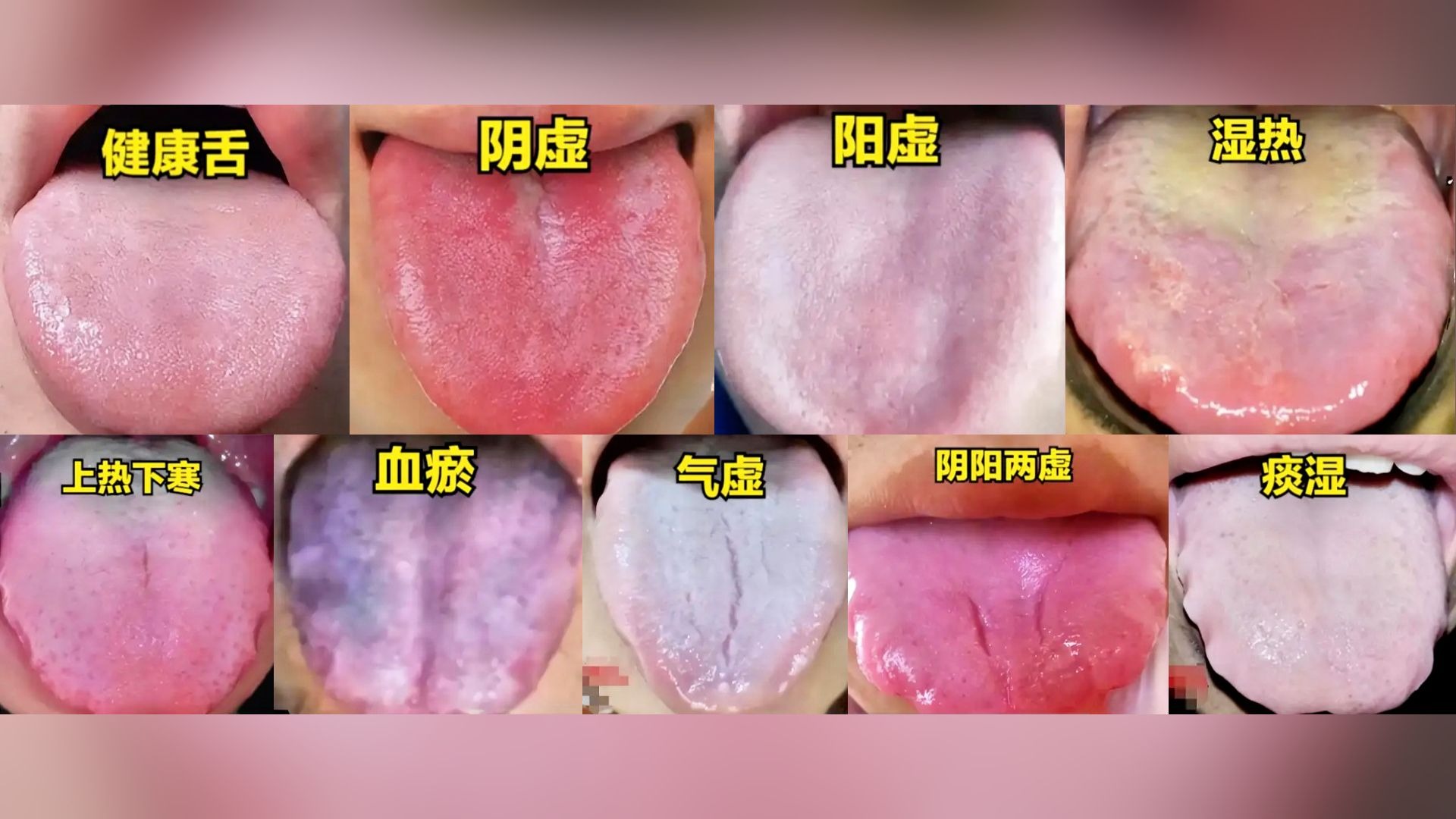中医9大体质舌象，1个视频告诉你，对照你是哪种？