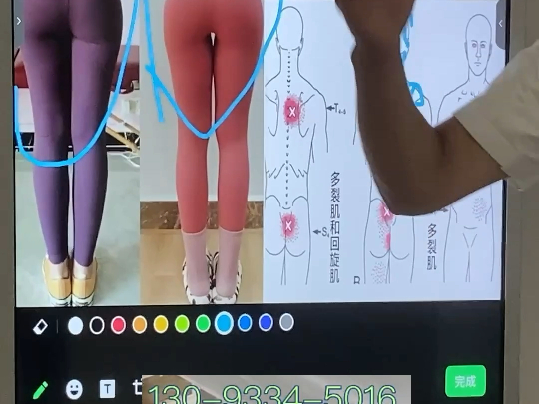 滑县腰间盘突出保守治疗有哪些方法？哪里治疗最好？