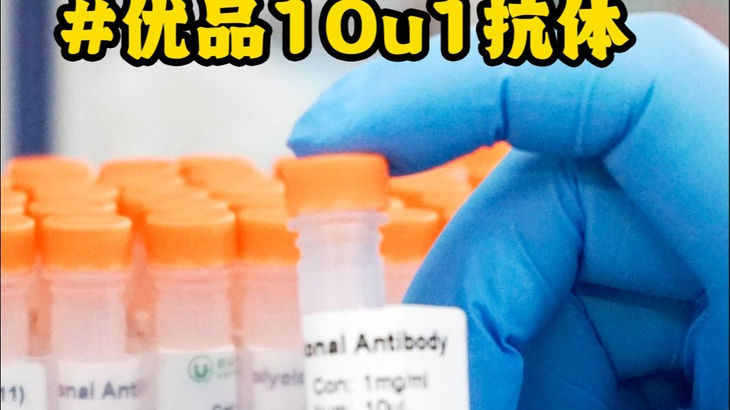 不搞冷暴力抗体界的暖男