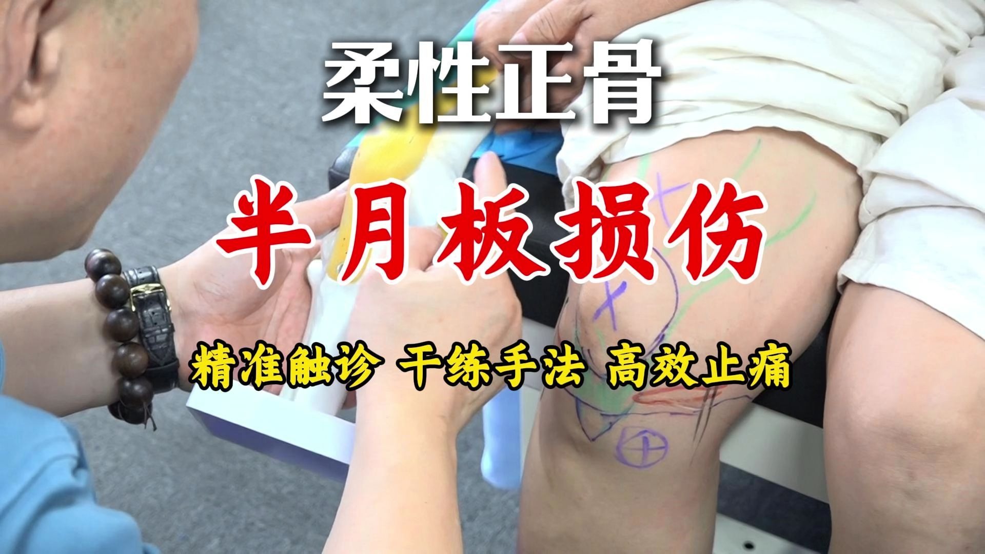 李德明柔性正骨教你如何准确诊断半月板问题，纯手法当场见效！