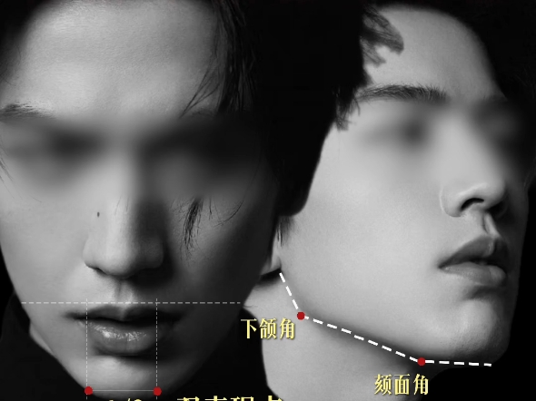 男性下巴审美黄金准则及调整思路