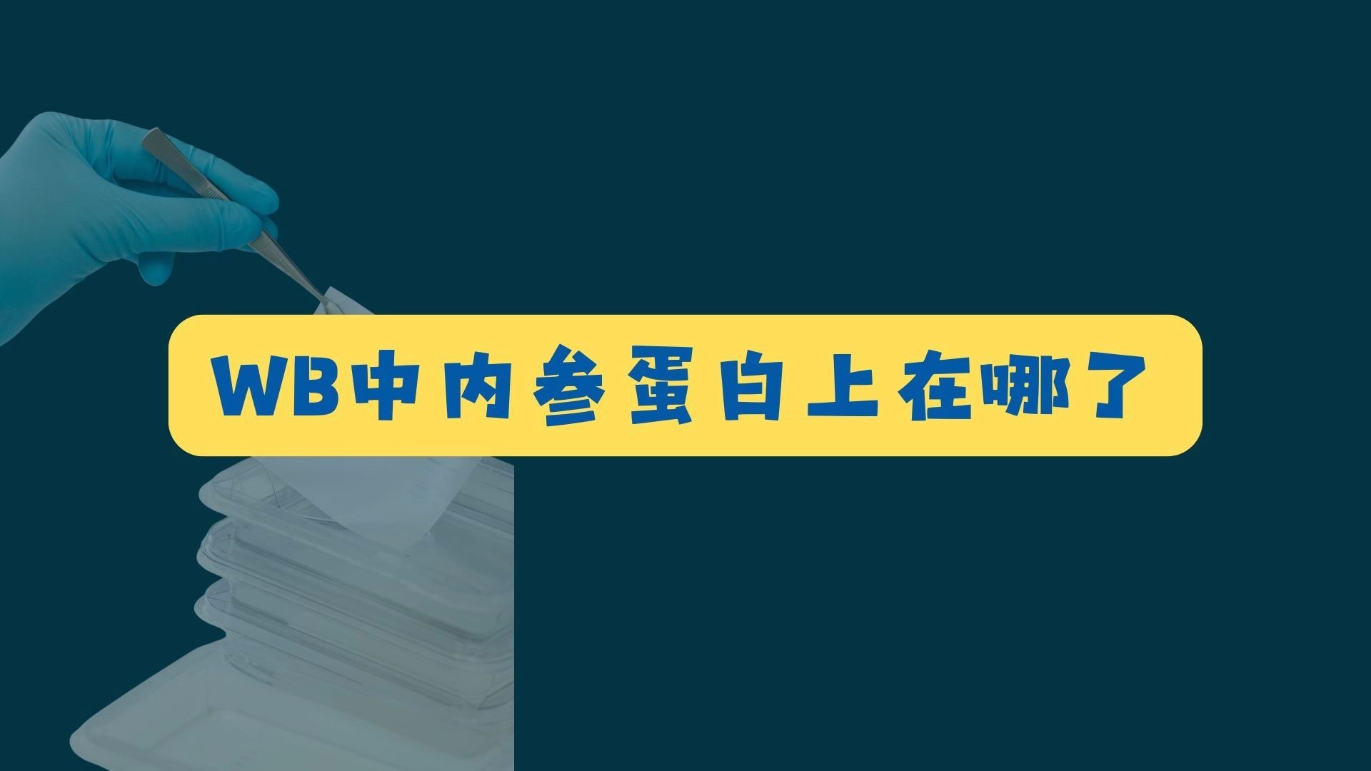 WB中内参蛋白上在哪了？