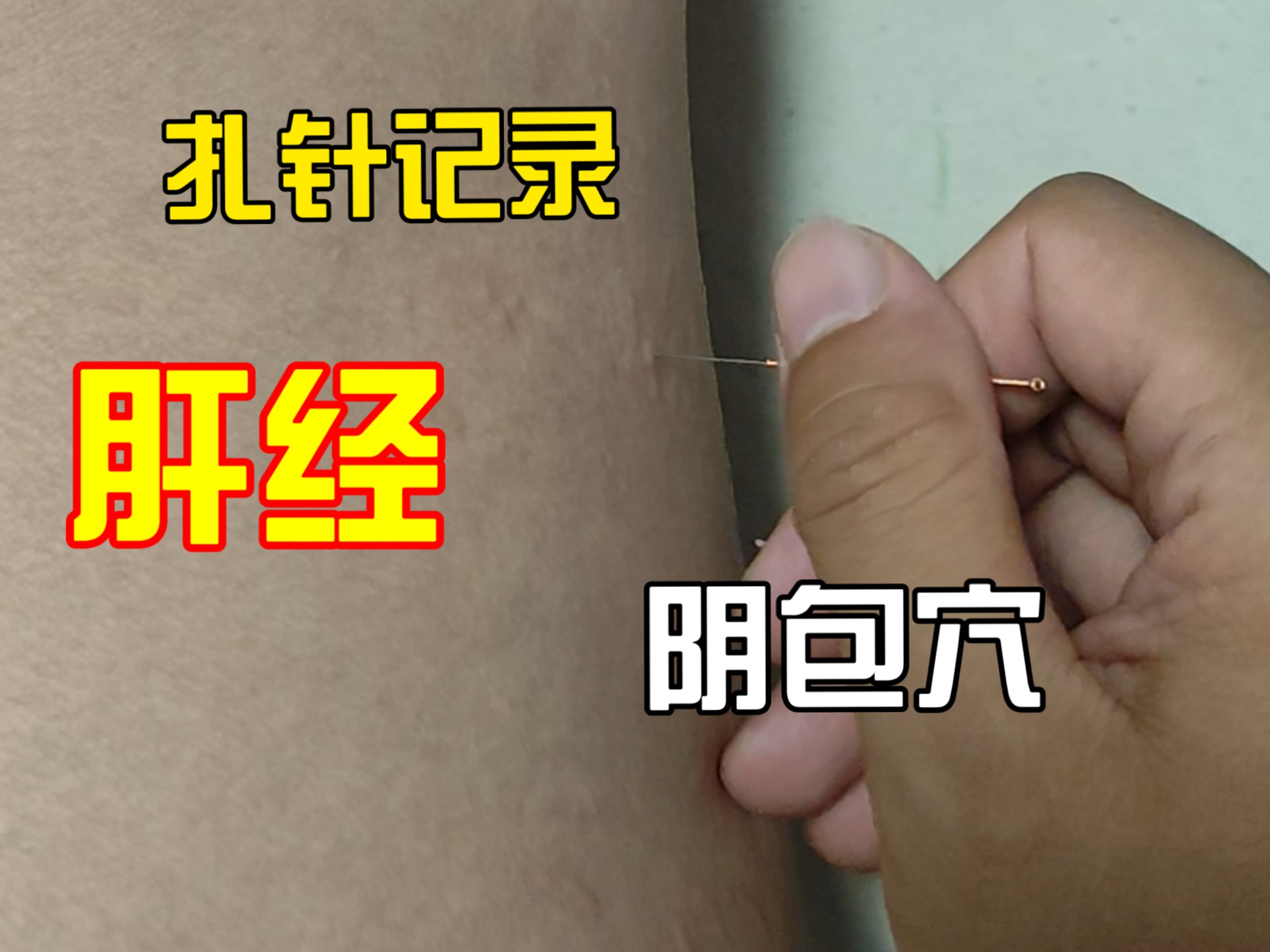 大腿内侧，肝经，阴包穴来一针