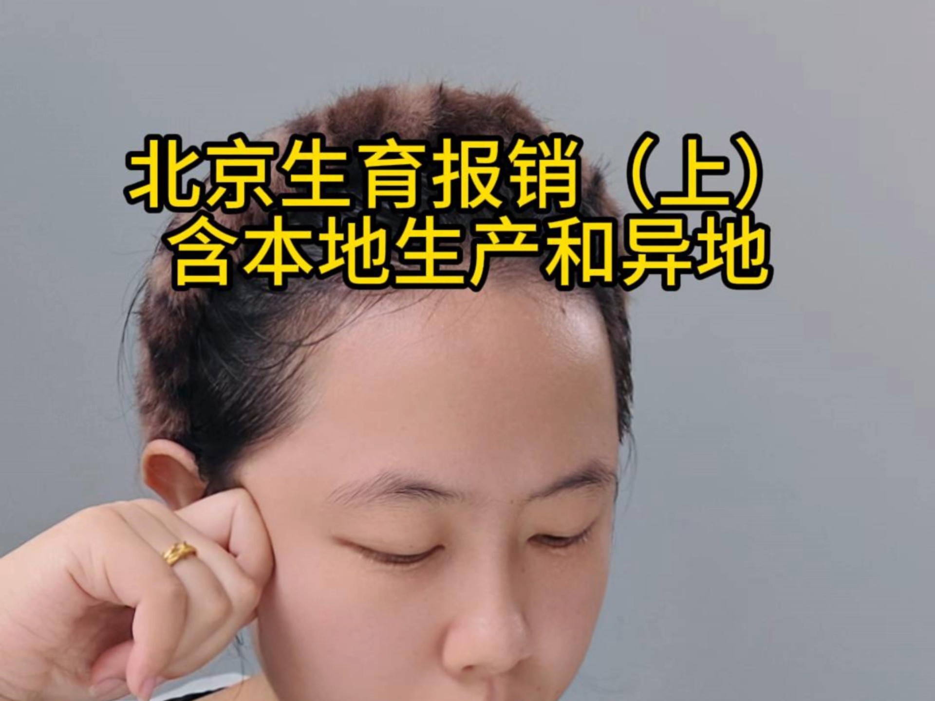 电话咨询医保局，生育报销相关，包含本地生育和异地