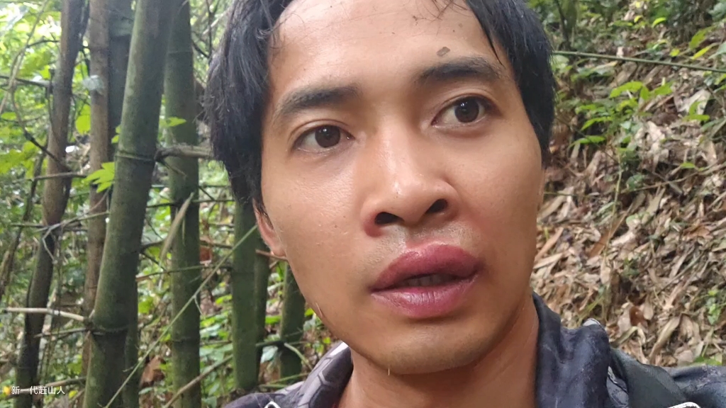 我的妈呀！被马蜂蜇了四五下，专挑嘴唇蜇，这谁顶得住